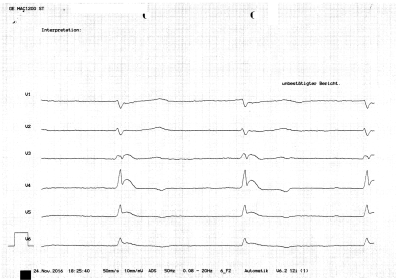 ekg-whg-anonymisiert1