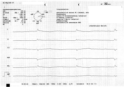 ekg-whg-anonymisiert